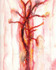 Carotid Artery In Red Watercolor - Original