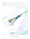 Cranial Nerve Viii: Vestibulocochlear Print Watercolor