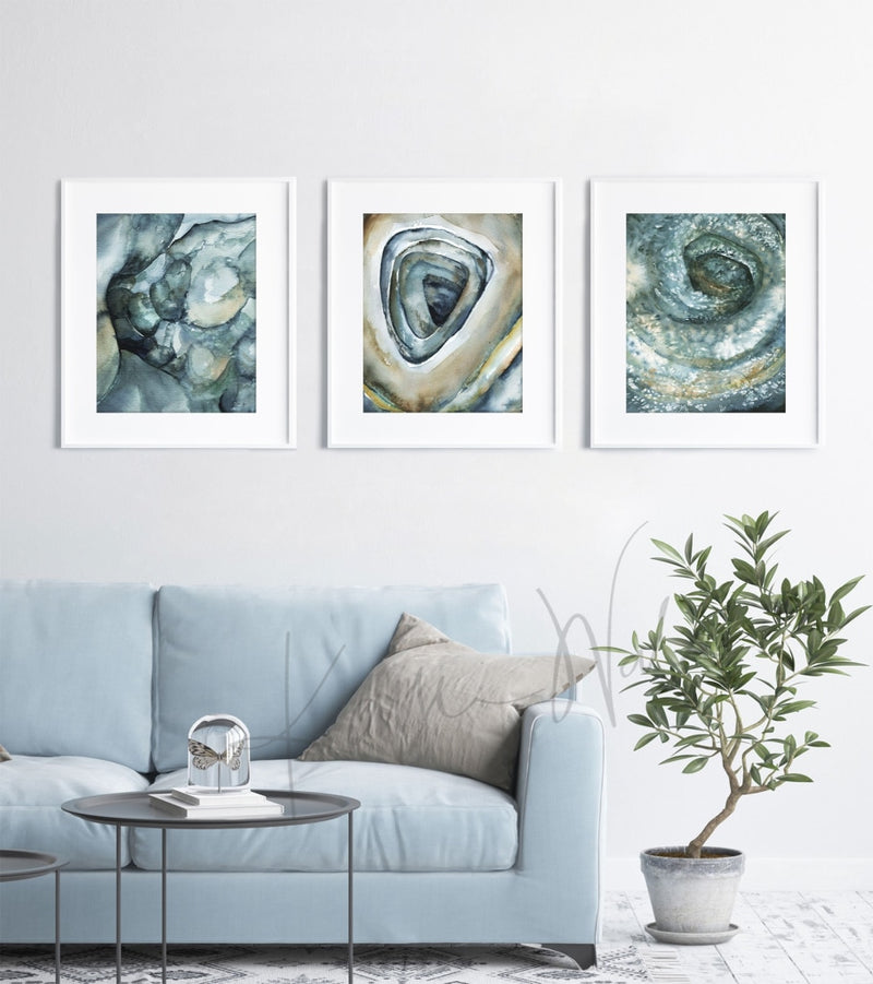 Normal Crohns And Ulcerative-Colitis Colonoscopy Watercolor Print Set