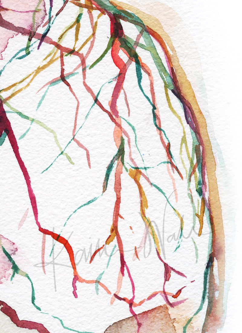 Zoomed in view of a watercolor painting showing a coronary angiogram x-ray image in reds, purples, greens, oranges and yellows