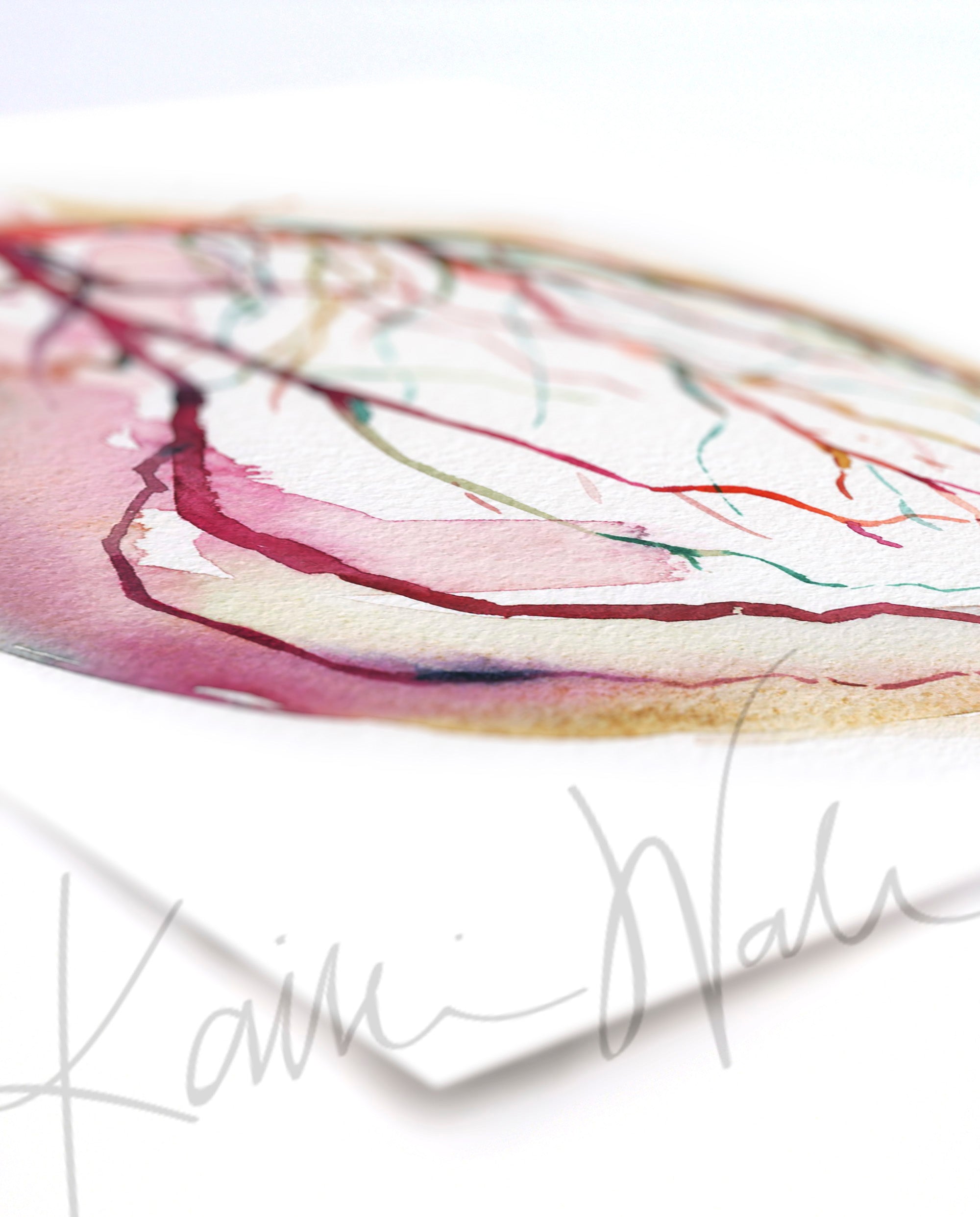  Unframed watercolor painting at an angle showing a coronary angiogram x-ray image in reds, purples, greens, oranges and yellows.