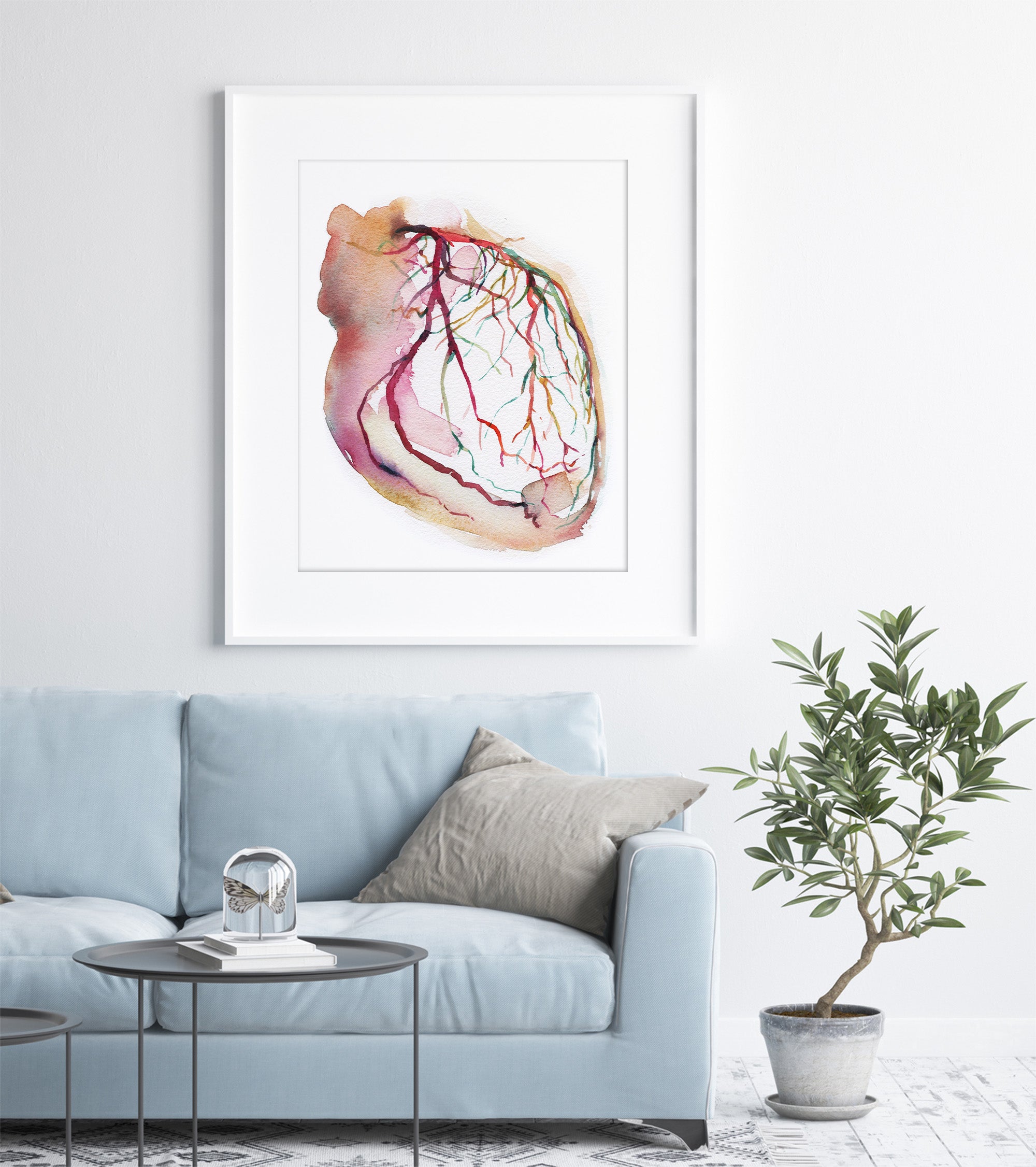 Framed watercolor painting showing a coronary angiogram x-ray image in reds, purples, greens, oranges and yellows. The painting is hanging over a blue couch.