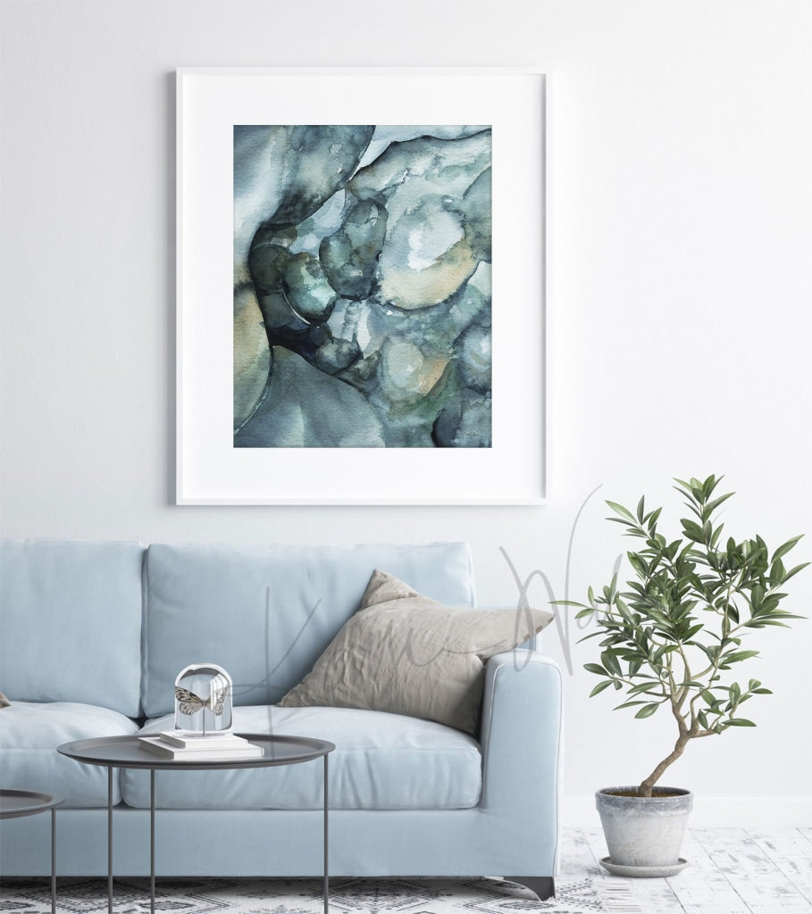 Crohns Disease Colonoscopy Watercolor Print