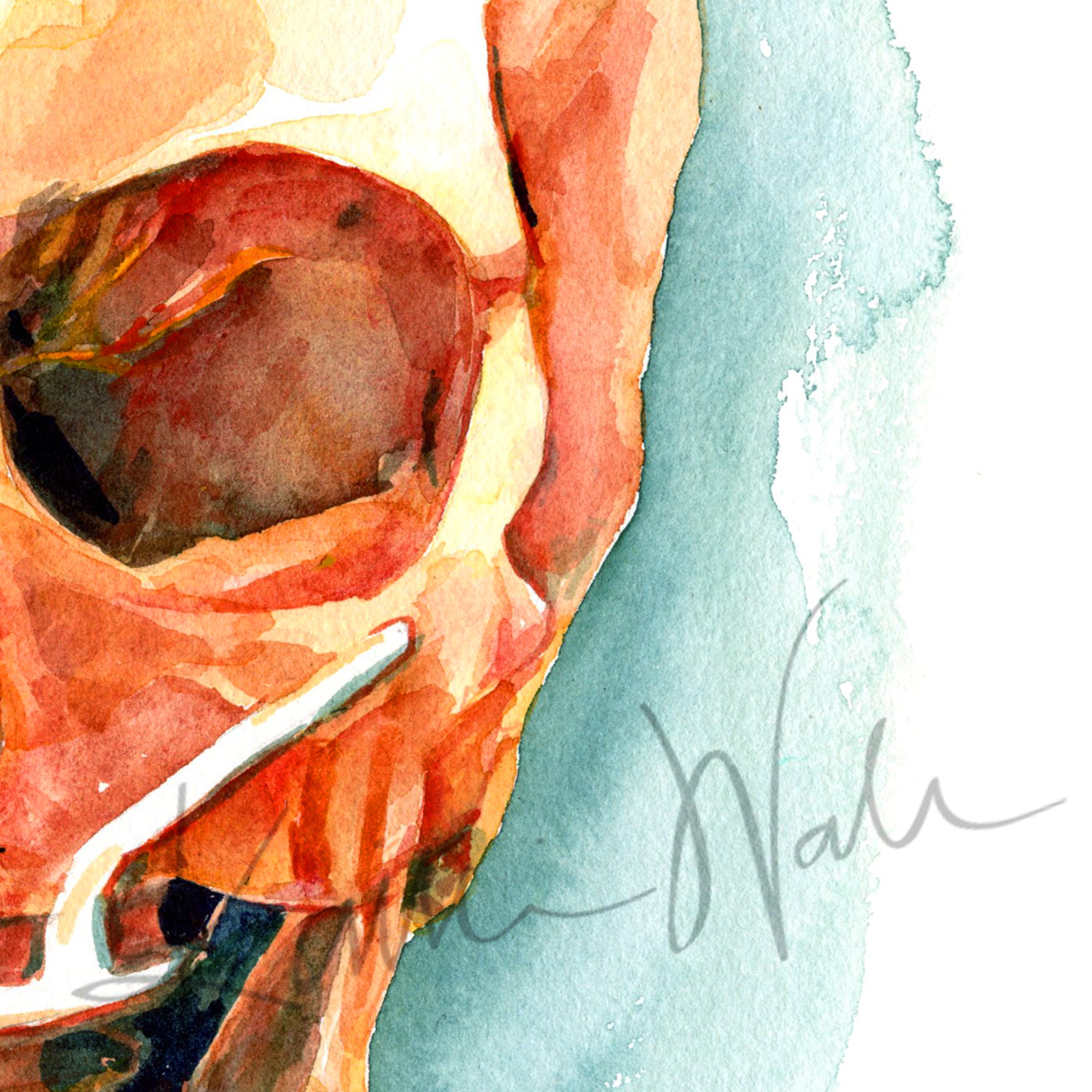 Zoomed in view of a watercolor painting of a mandibular and maxillary all on 4 with two anterior implants and 2 zygomatic implants.