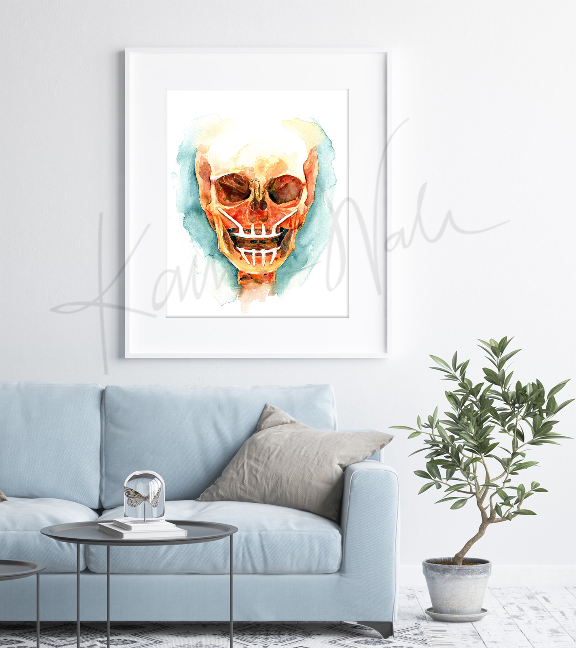 Framed watercolor painting of a mandibular and maxillary all on 4 with two anterior implants and 2 zygomatic implants. The painting is hanging over a blue couch.
