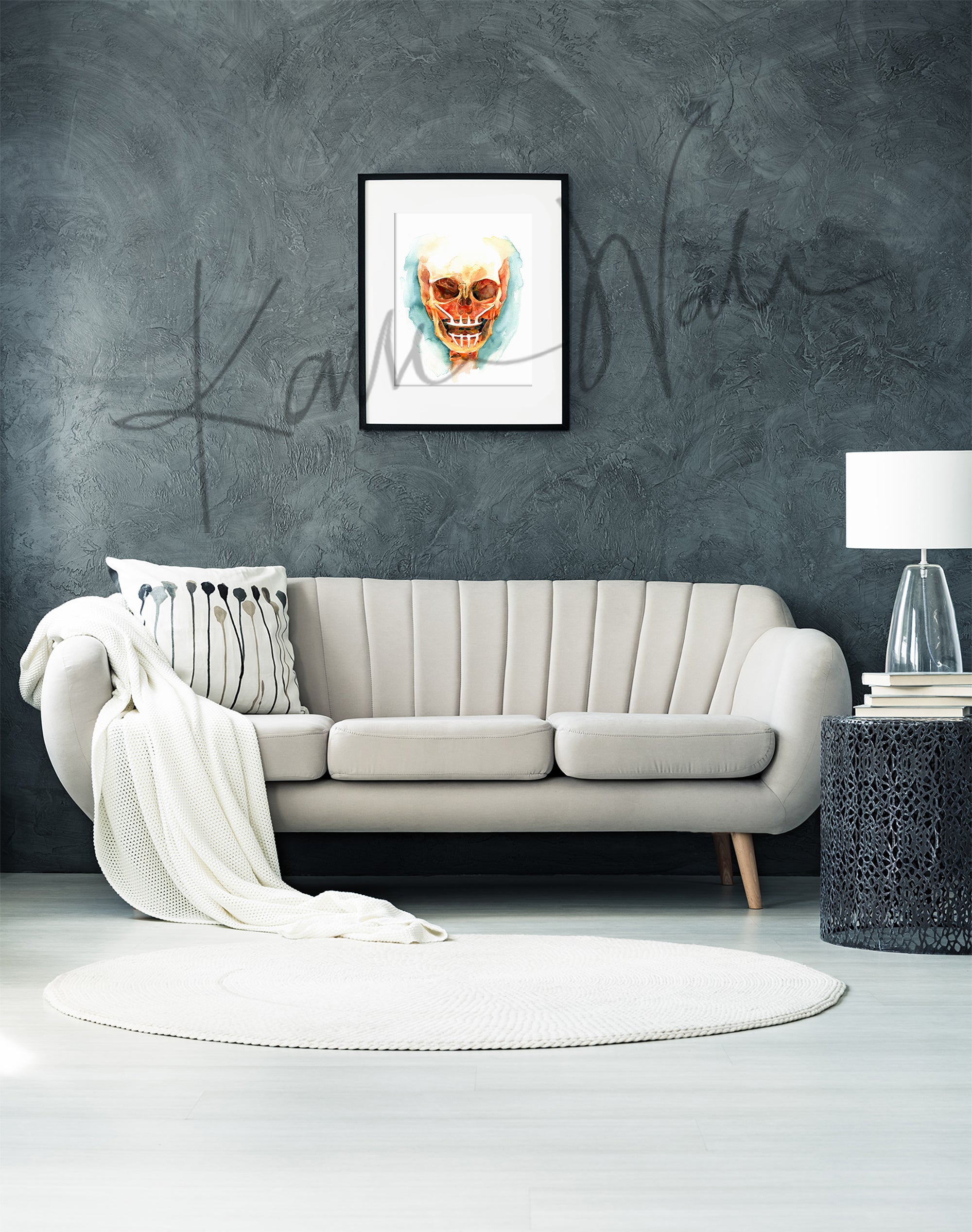 Framed watercolor painting of a mandibular and maxillary all on 4 with two anterior implants and 2 zygomatic implants. The painting is hanging over a white couch.