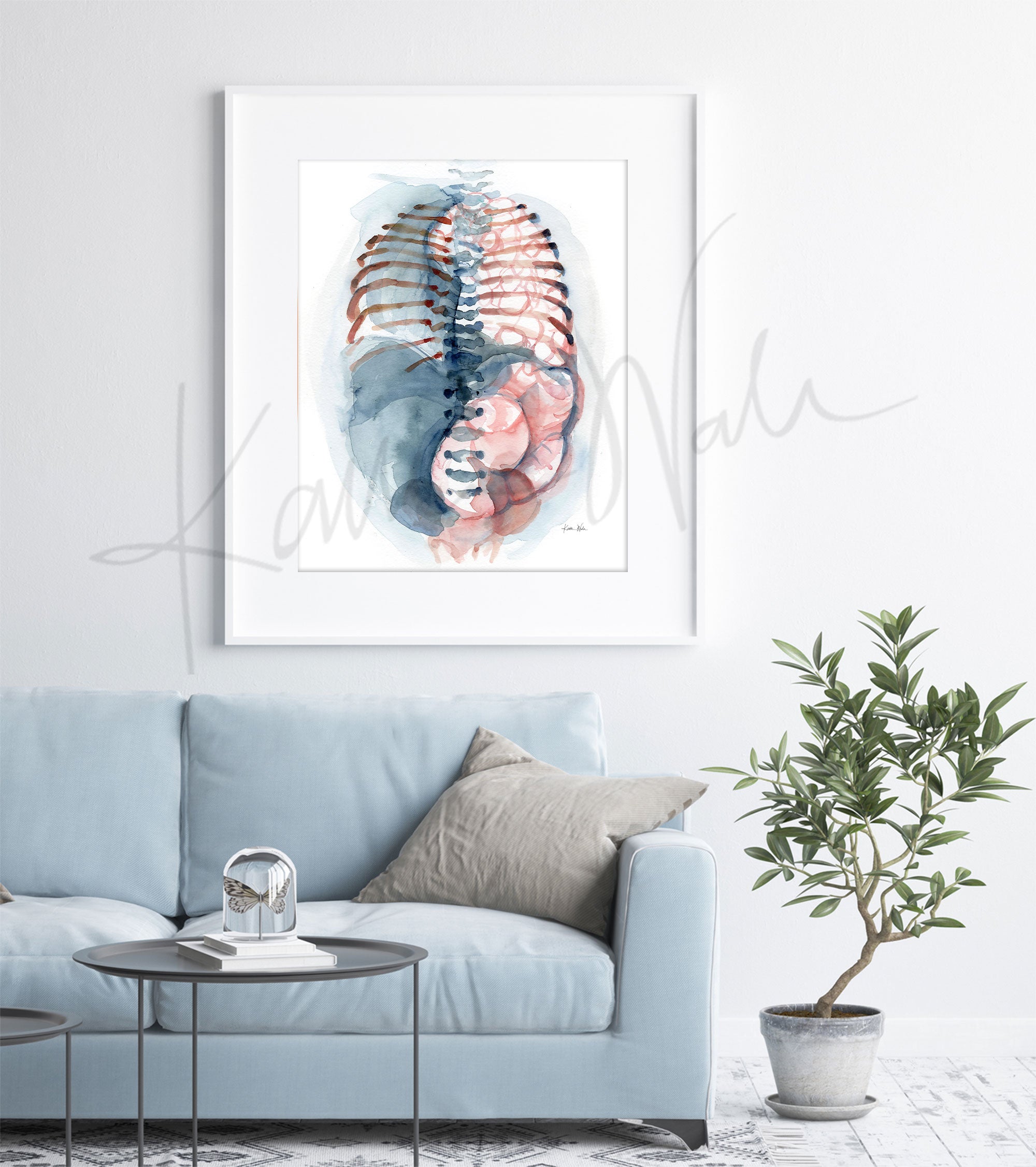 Framed watercolor painting of a diaphragmatic hernia. The painting is hanging over a blue couch.