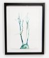 Anatomical Original Watercolor Painting of The Aortica in Green and Framed