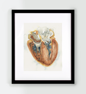 Hypertrophic Cardiomyopathy Heart Watercolor - Original