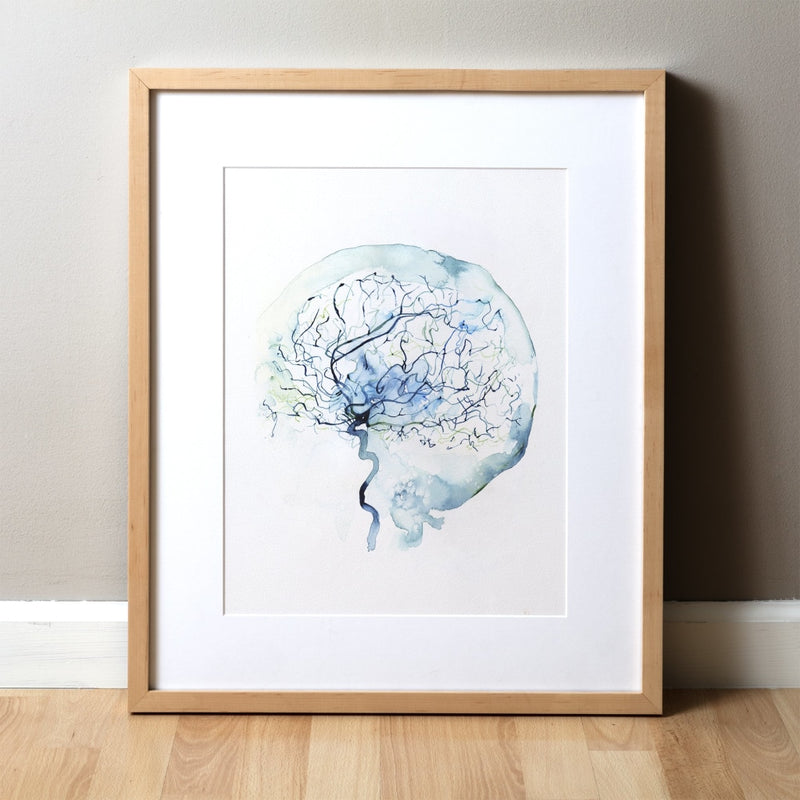 Cerebral Angiography Fine Art Watercolor Print. Abstract anatomy art that is a great medical or doctor gift.