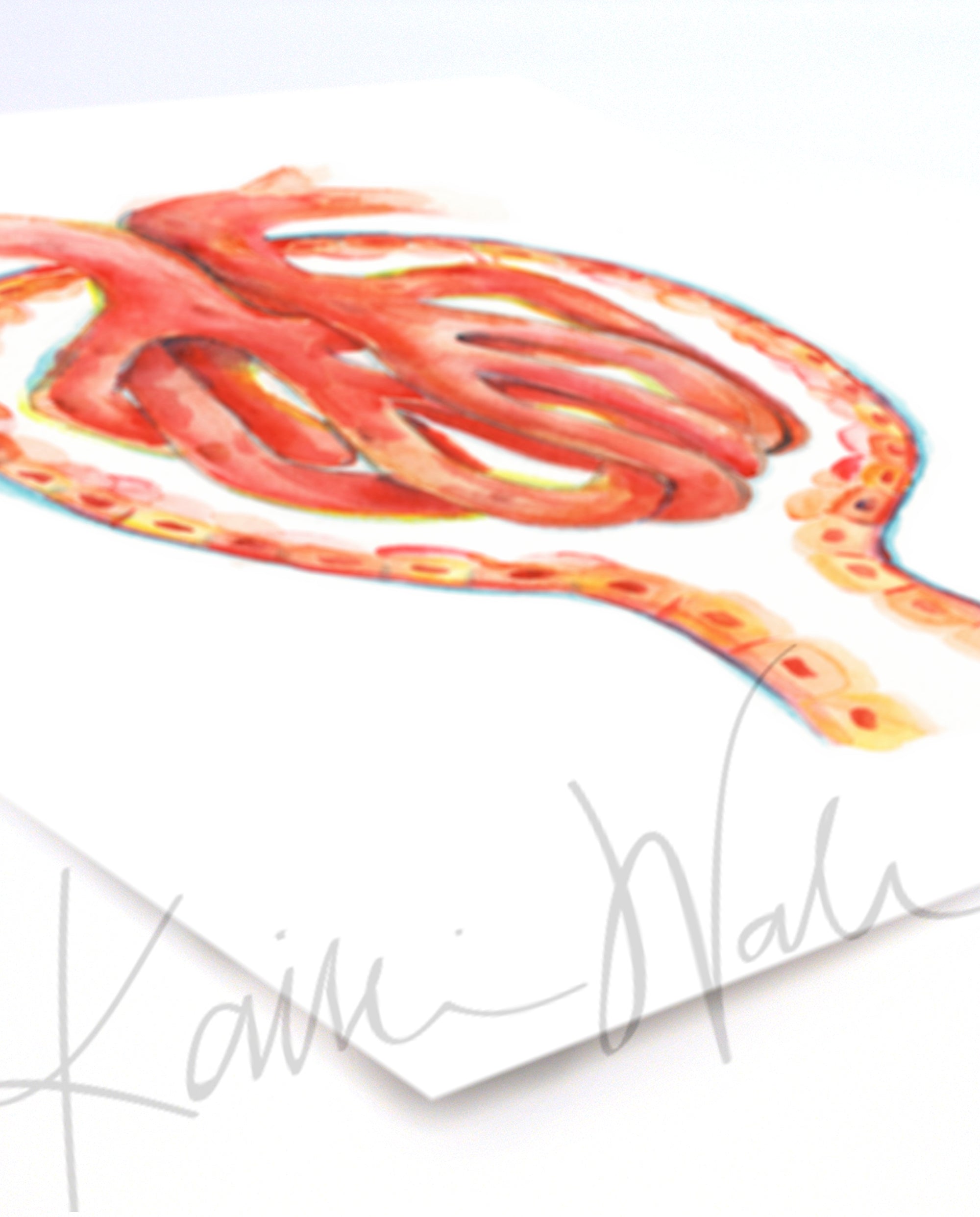 Watercolor painting of a glomerulus in scarlets, oranges, and yellows. The painting is at an angle.