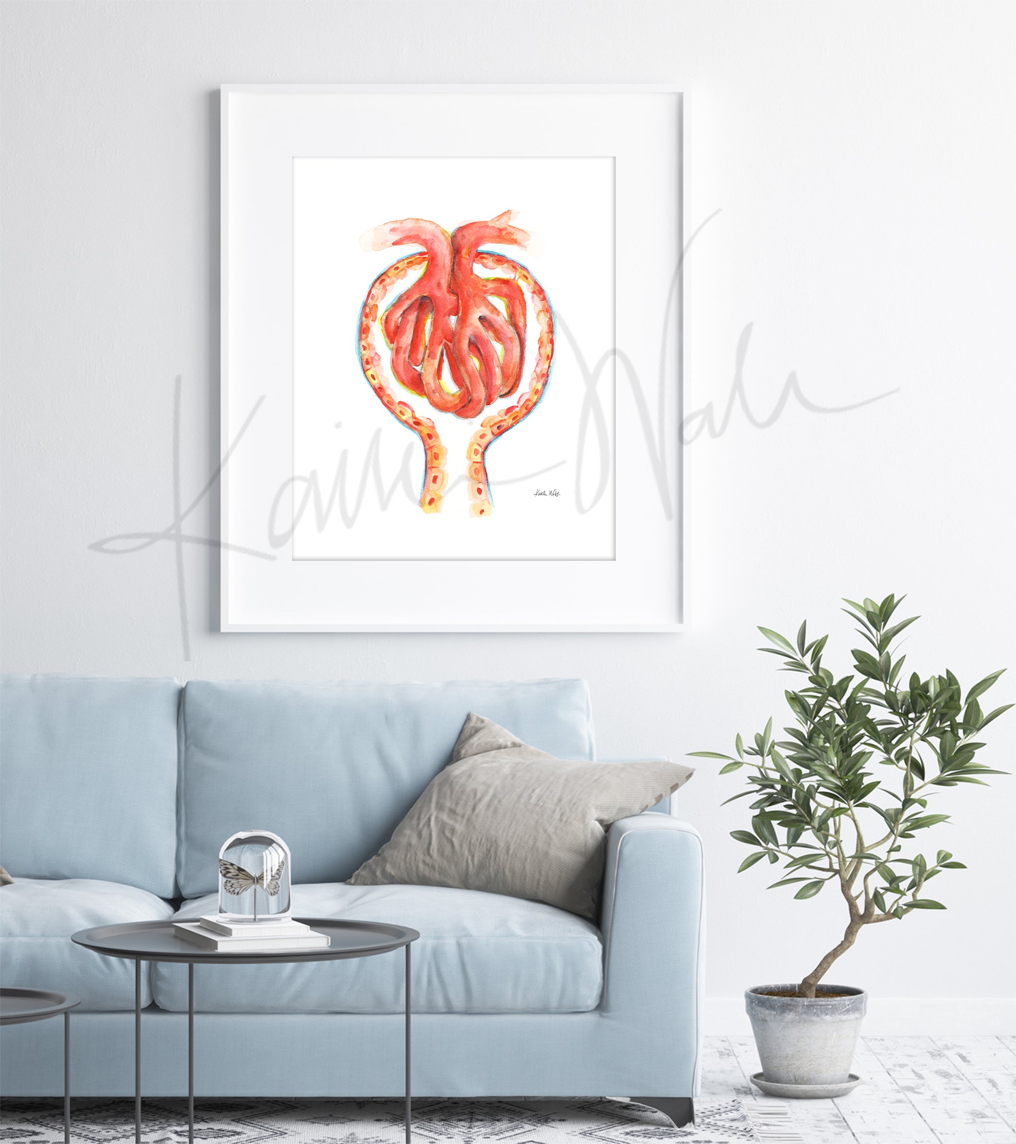 Framed watercolor painting showing a glomerulus in scarlets, oranges, and yellows. The painting is hanging over a blue couch.