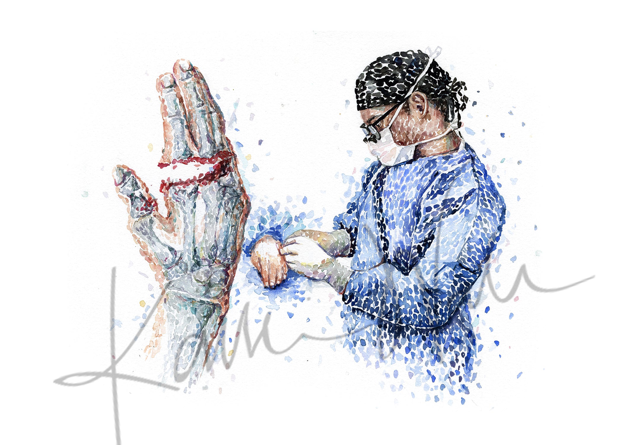 Unframed watercolor painting of a finger amputation surgery.