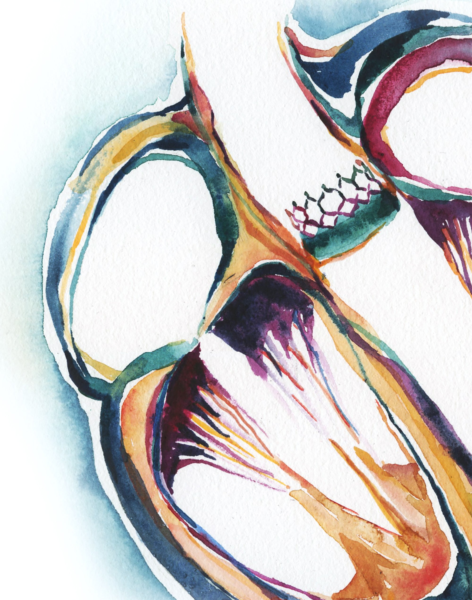 Heart Valve Replacement Watercolor Print