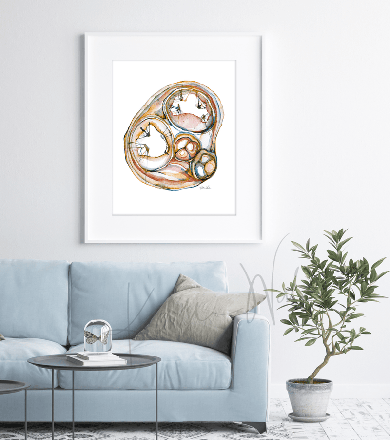 Cross Sectioned Heart Print Watercolor framed in a doctor's office- clinic decor