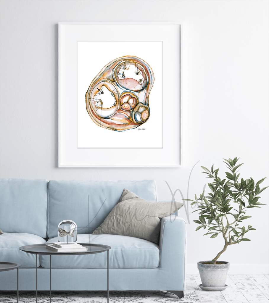 Cross Sectioned Heart Print Watercolor framed in a doctor's office- clinic decor