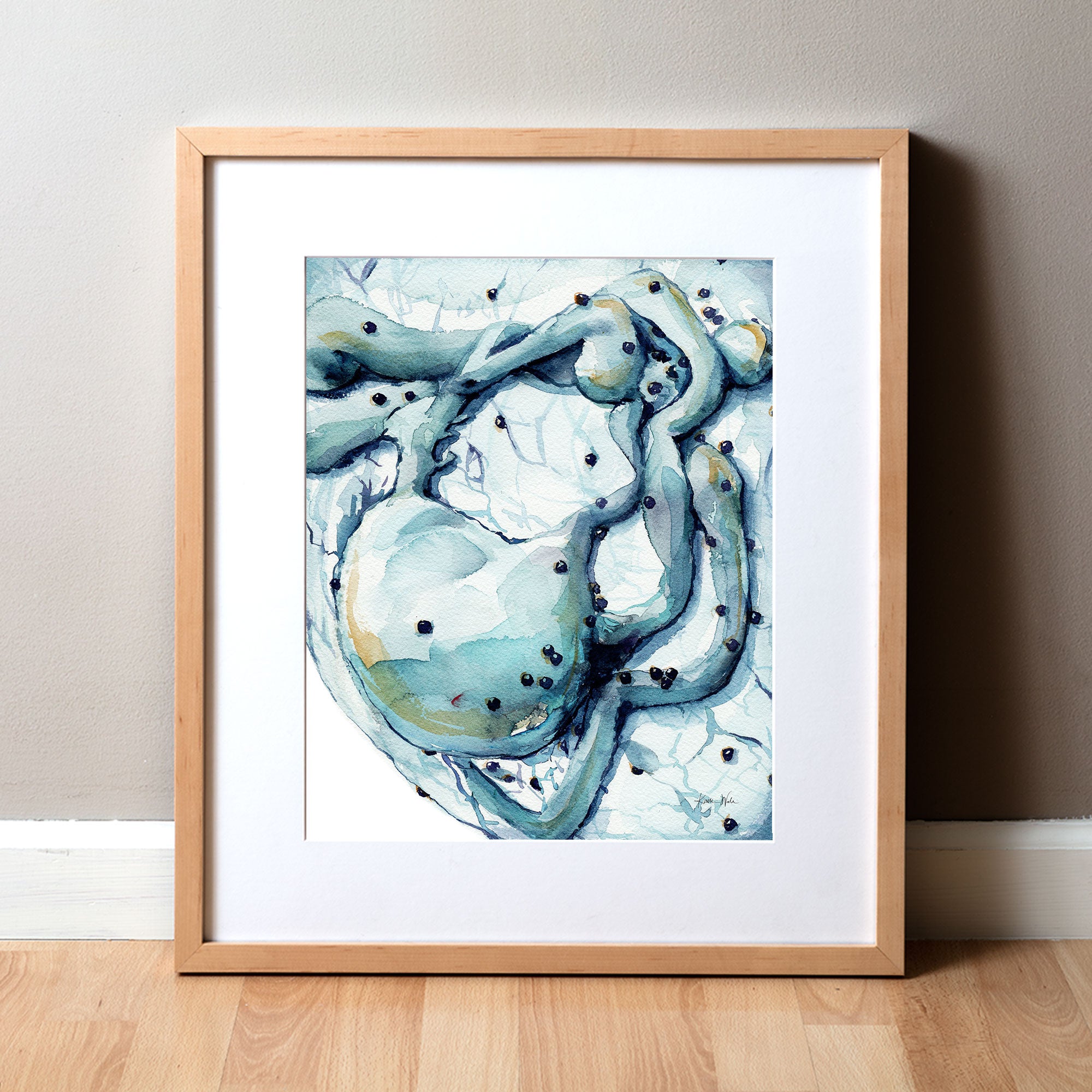 Framed watercolor painting of HIV embedding itself into a lymphocyte.