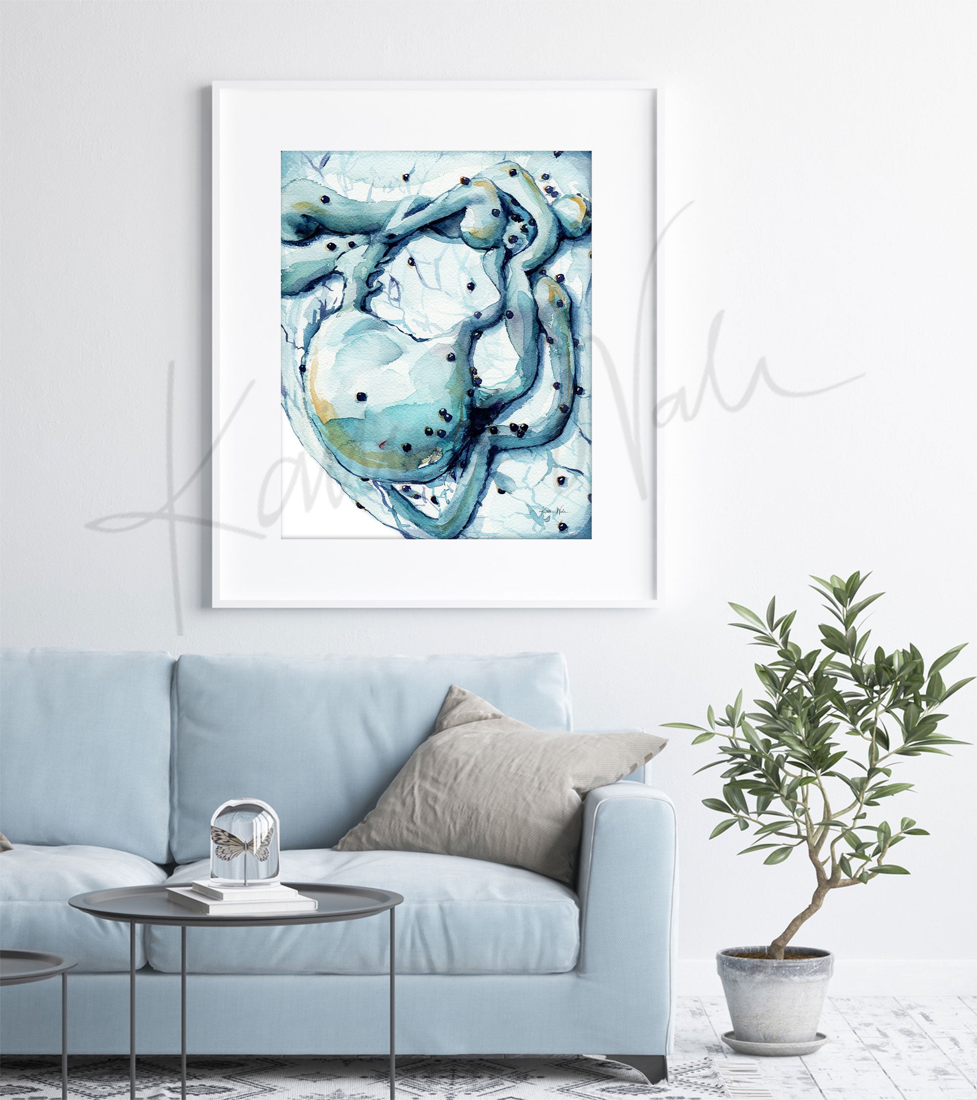 Framed watercolor painting of HIV embedding itself into a lymphocyte. The painting is hanging over a blue couch.