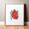 Hypoplastic Left Heart Syndrome (Hlhs) Print Watercolor