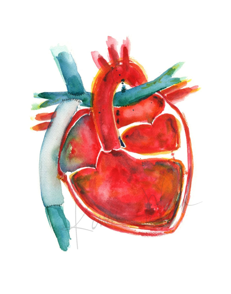 Hypoplastic Left Heart Syndrome (Hlhs) Print Watercolor