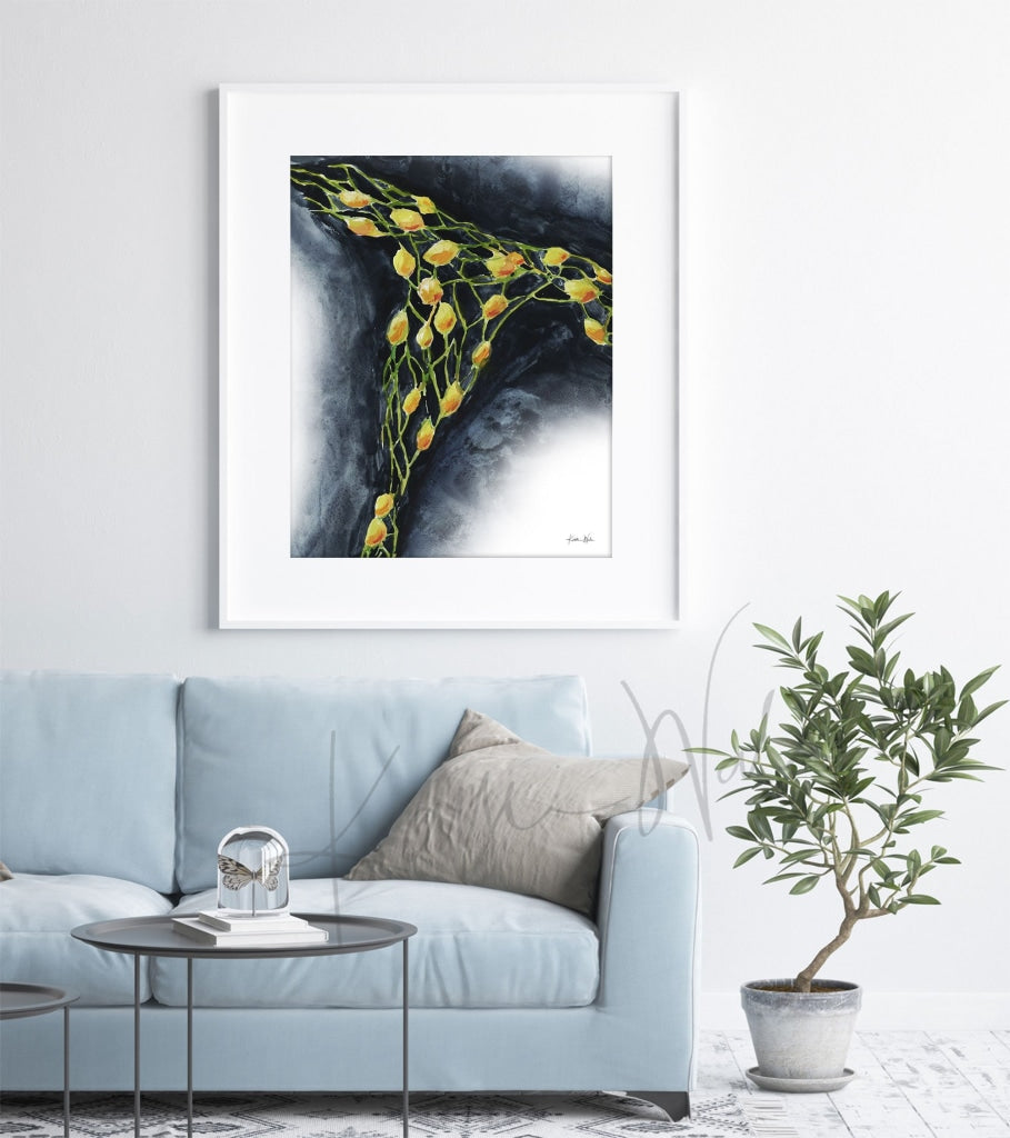 Lymph Nodes Watercolor Print