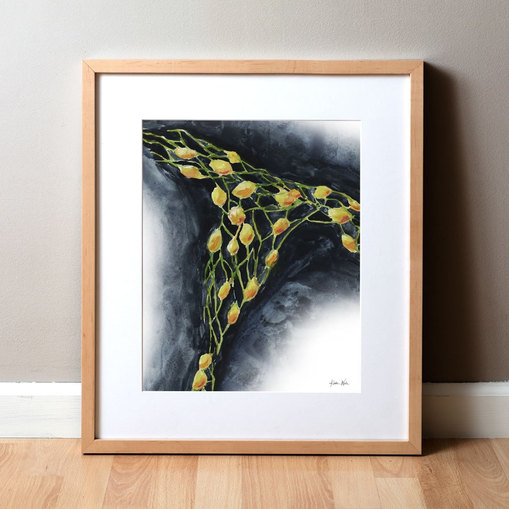 Lymph Nodes Watercolor Print