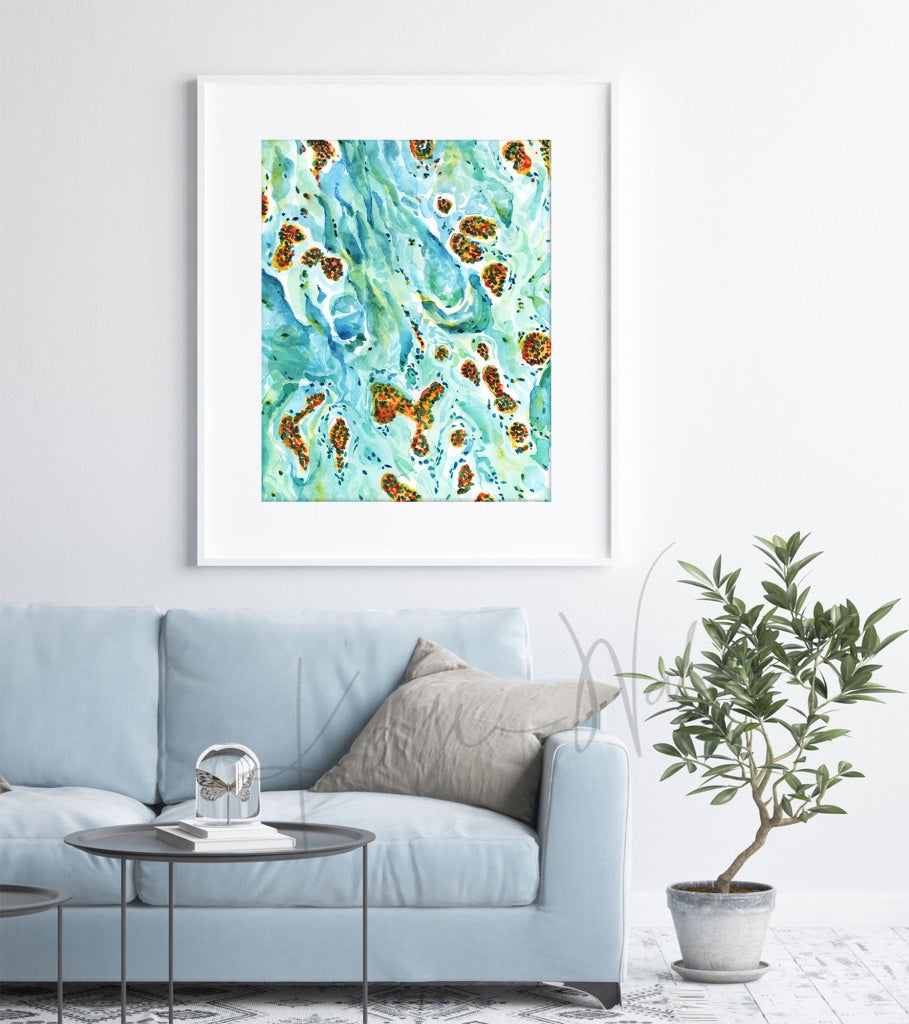 Melanoma Watercolor Print