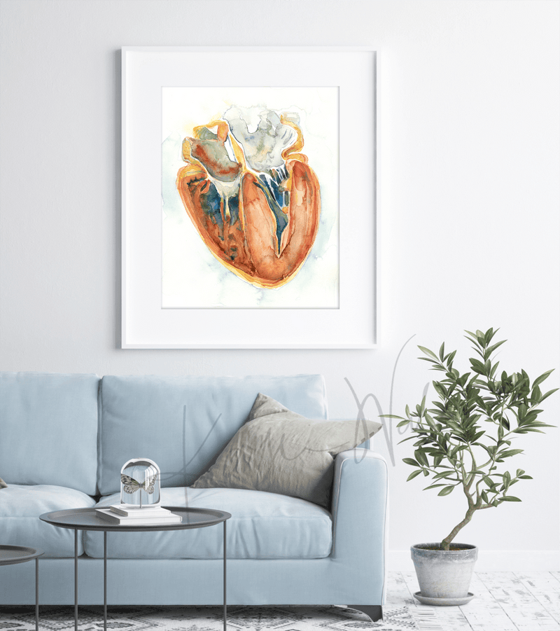 Hypertrophic Cardiomyopathy Heart Watercolor Print