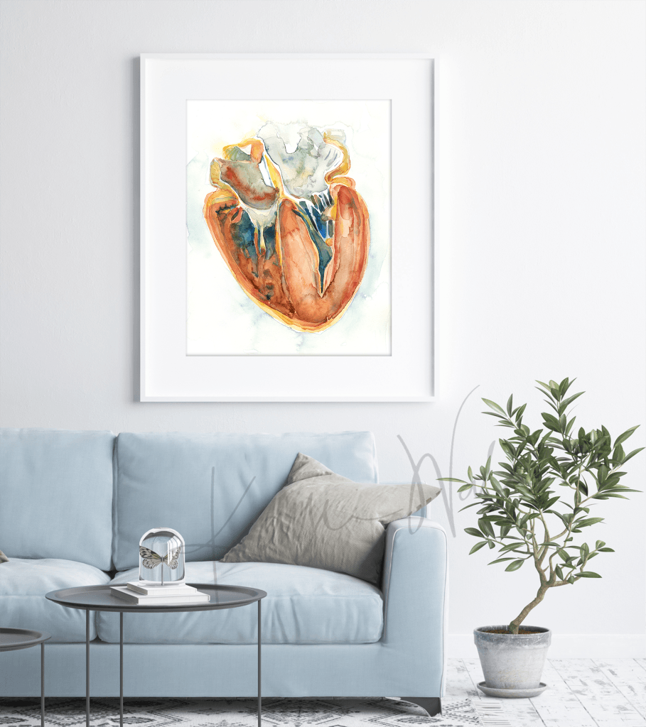 Hypertrophic Cardiomyopathy Heart Watercolor Print