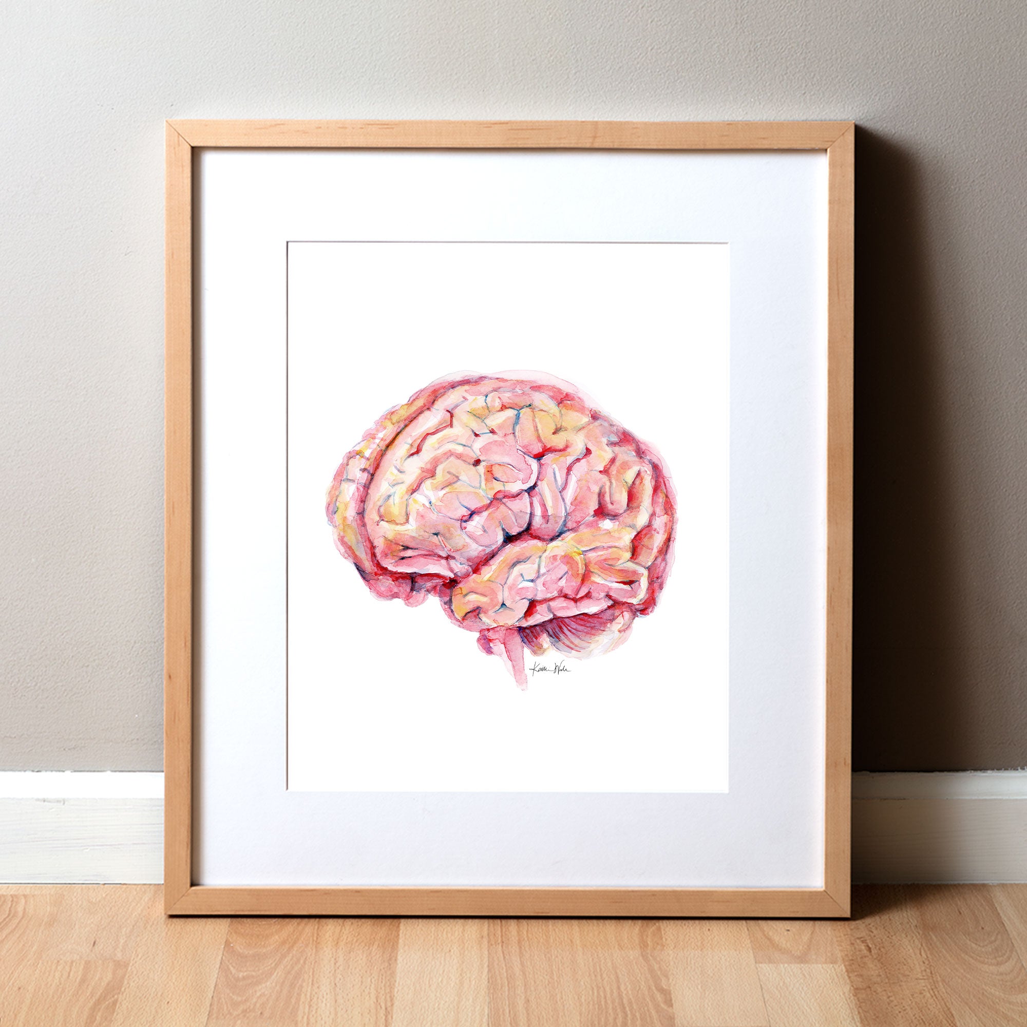 Brain Disease Prevention Watercolor Print