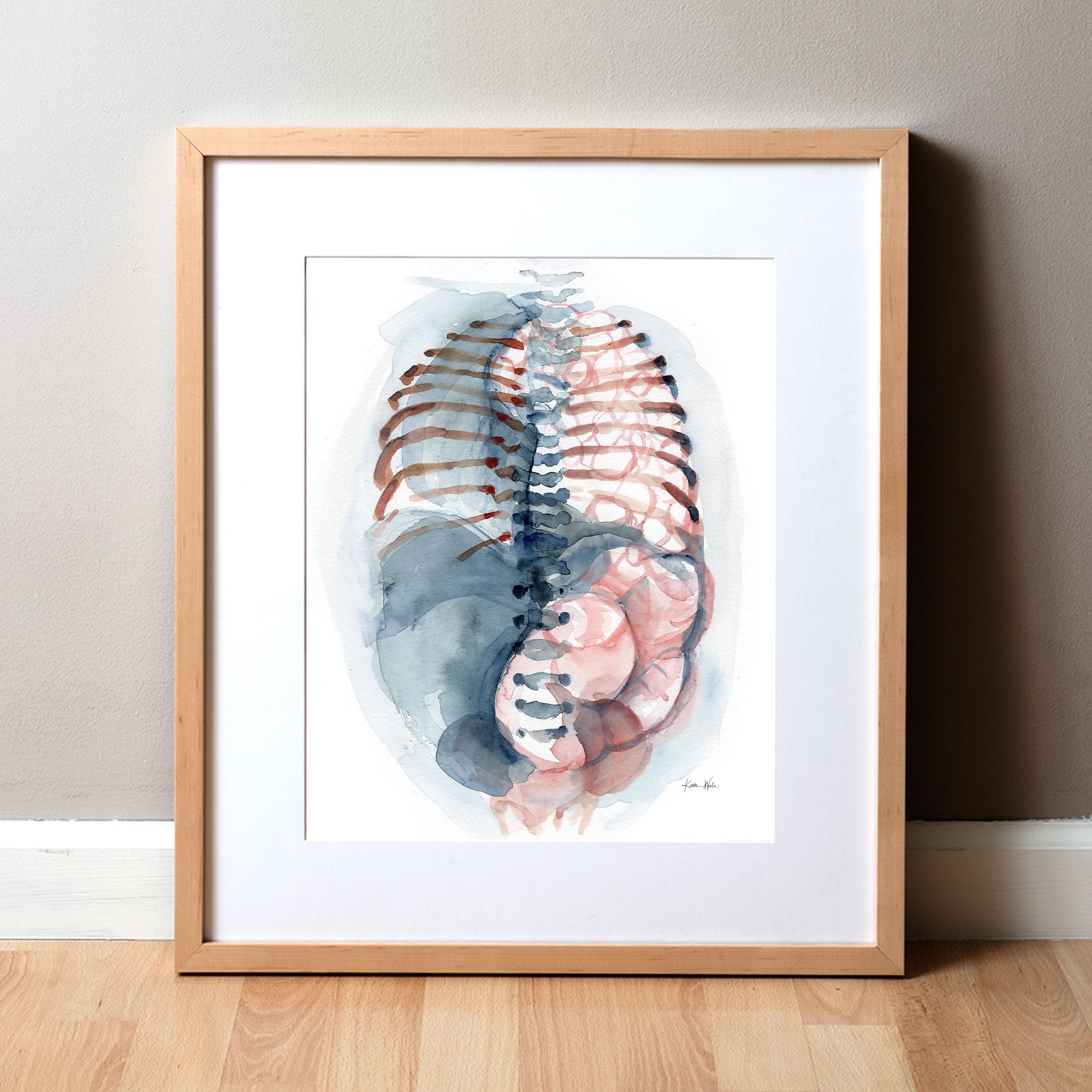 Framed watercolor painting of a diaphragmatic hernia.