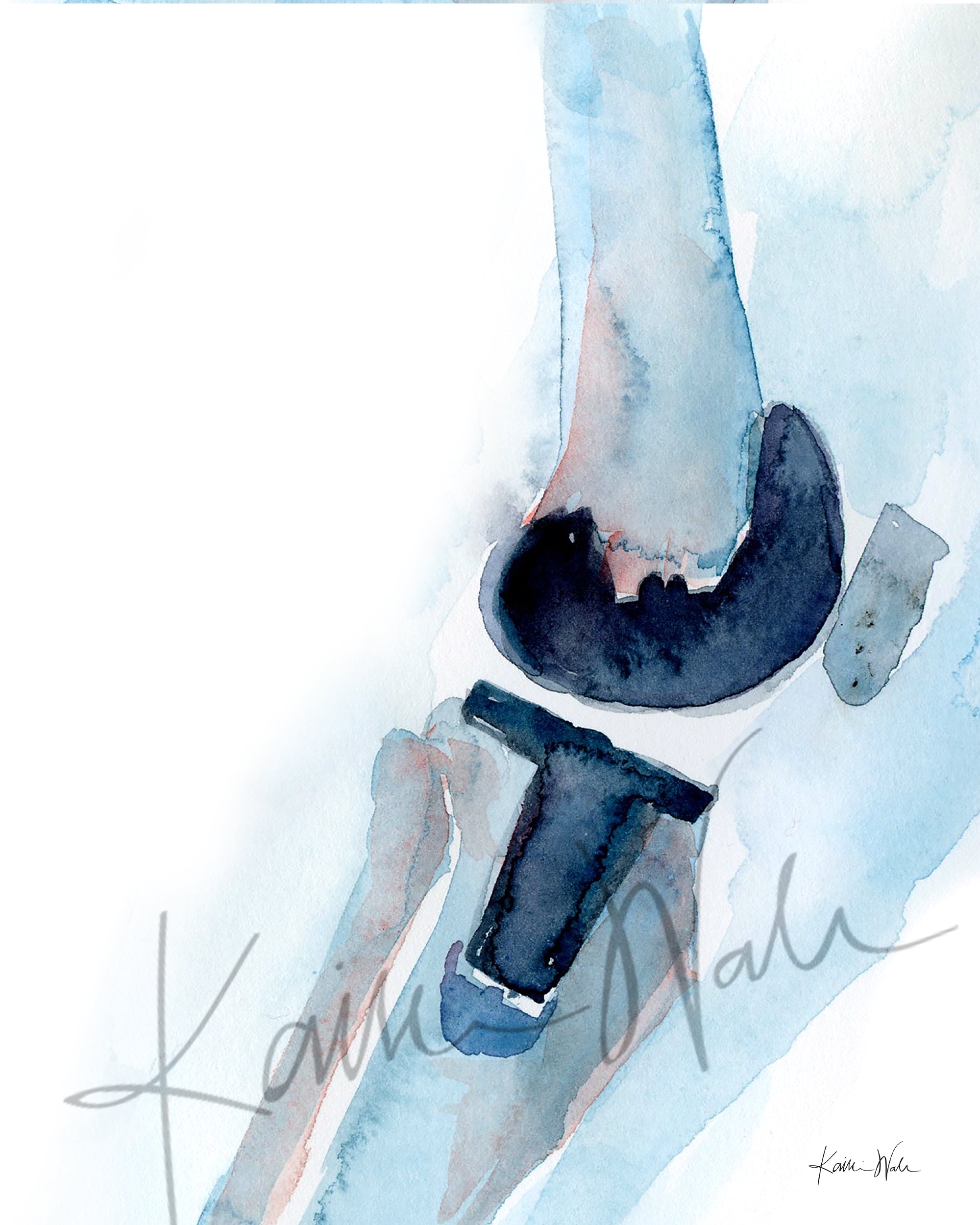 Hip, Shoulder, and Knee Orthopedics Watercolor Print Set