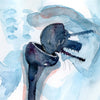 Orthopedics Print Watercolor
