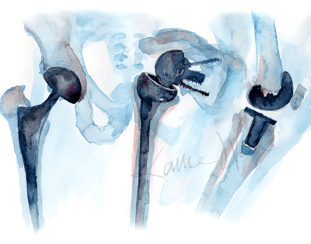 Orthopedics Print Watercolor