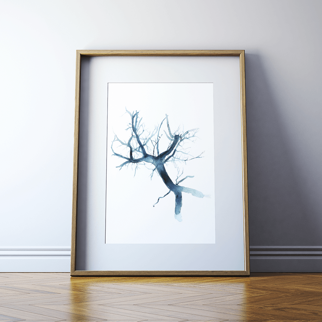 Portal Vein Watercolor Print