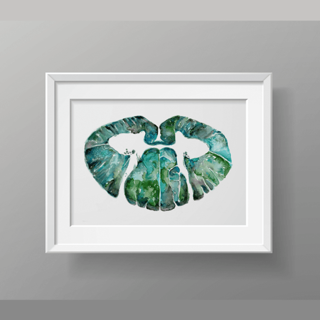 Anatomy art Cervical Spinal Cord Print Watercolor, art for doctor's office or medical clinic