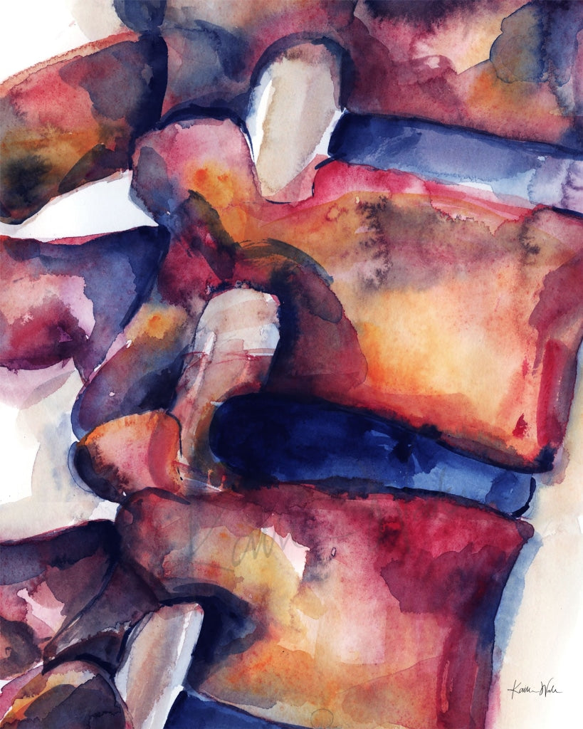 Disc Bulge Watercolor Print - Spine Art Orthopedic