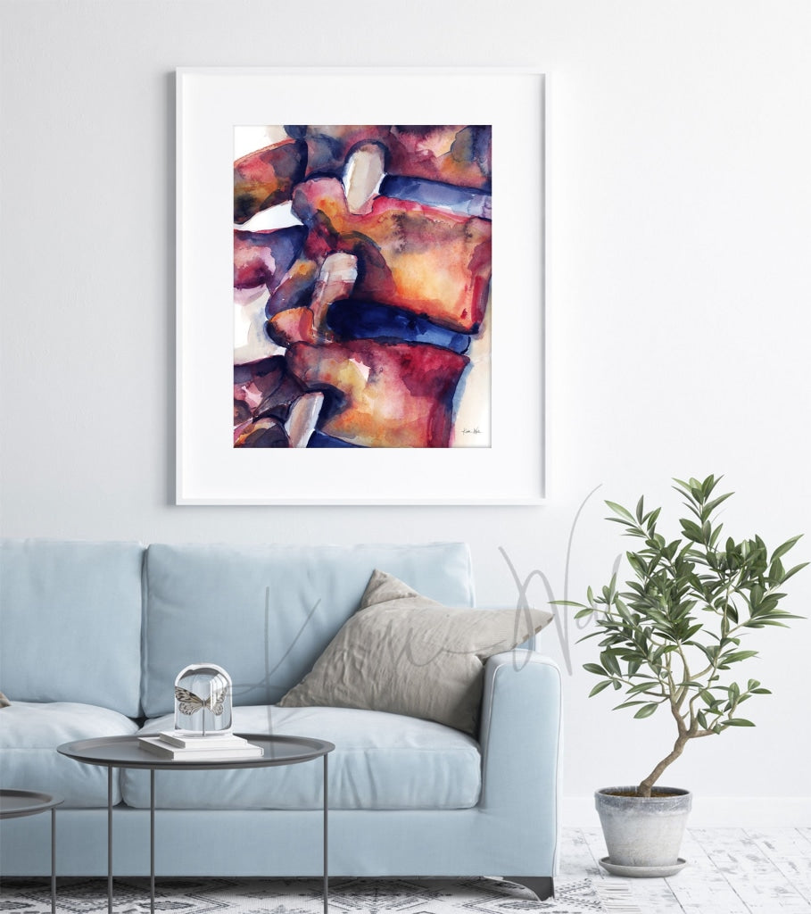 Disc Bulge Watercolor Print - Spine Art Orthopedic