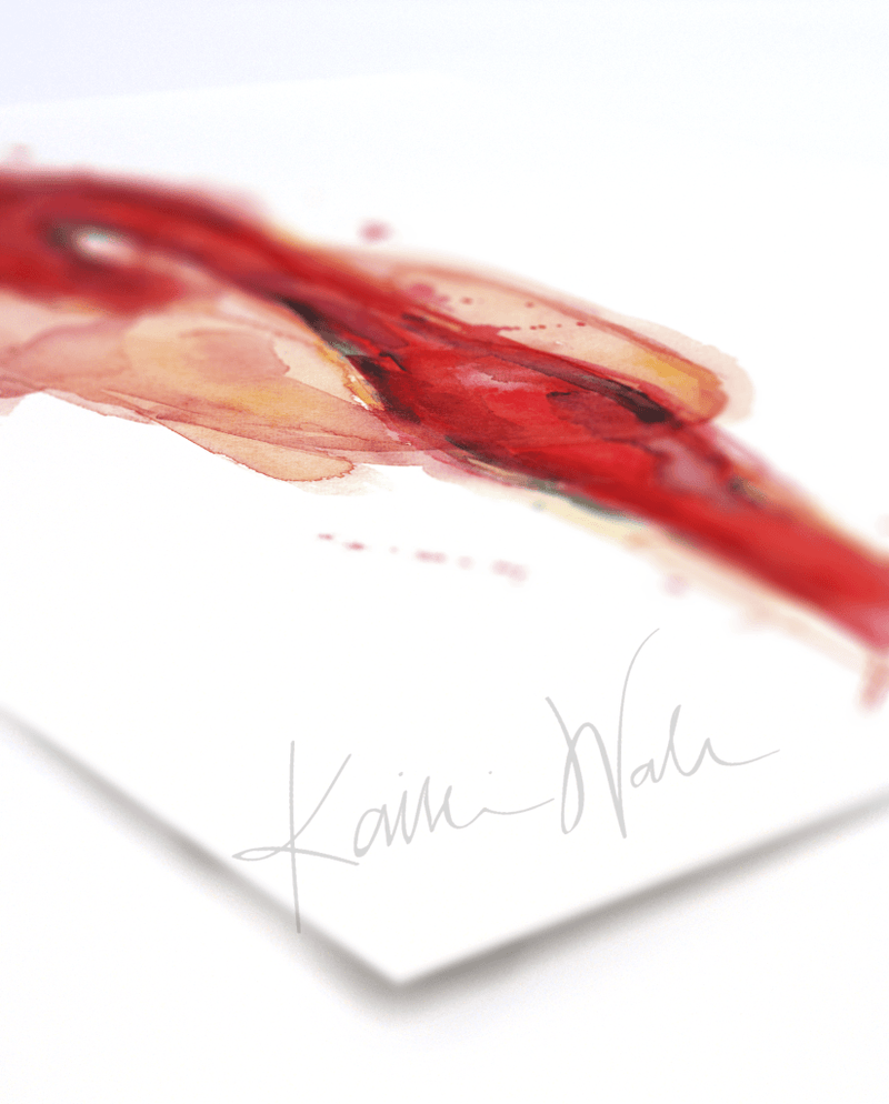 Thoracic Aneurysm Print Watercolor- Quality Watercolor print - Gift for Cardiologist- Anatomy Art