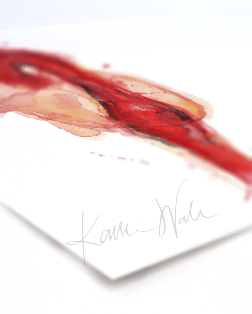 Thoracic Aneurysm Print Watercolor- Quality Watercolor print - Gift for Cardiologist- Anatomy Art