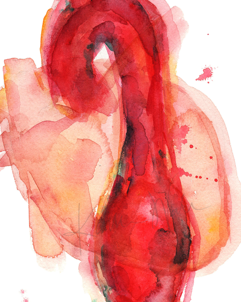 Thoracic Aneurysm Print Watercolor- Professional Watercolor Print- Gift for Doctor- Medical Art- Anatomy Art