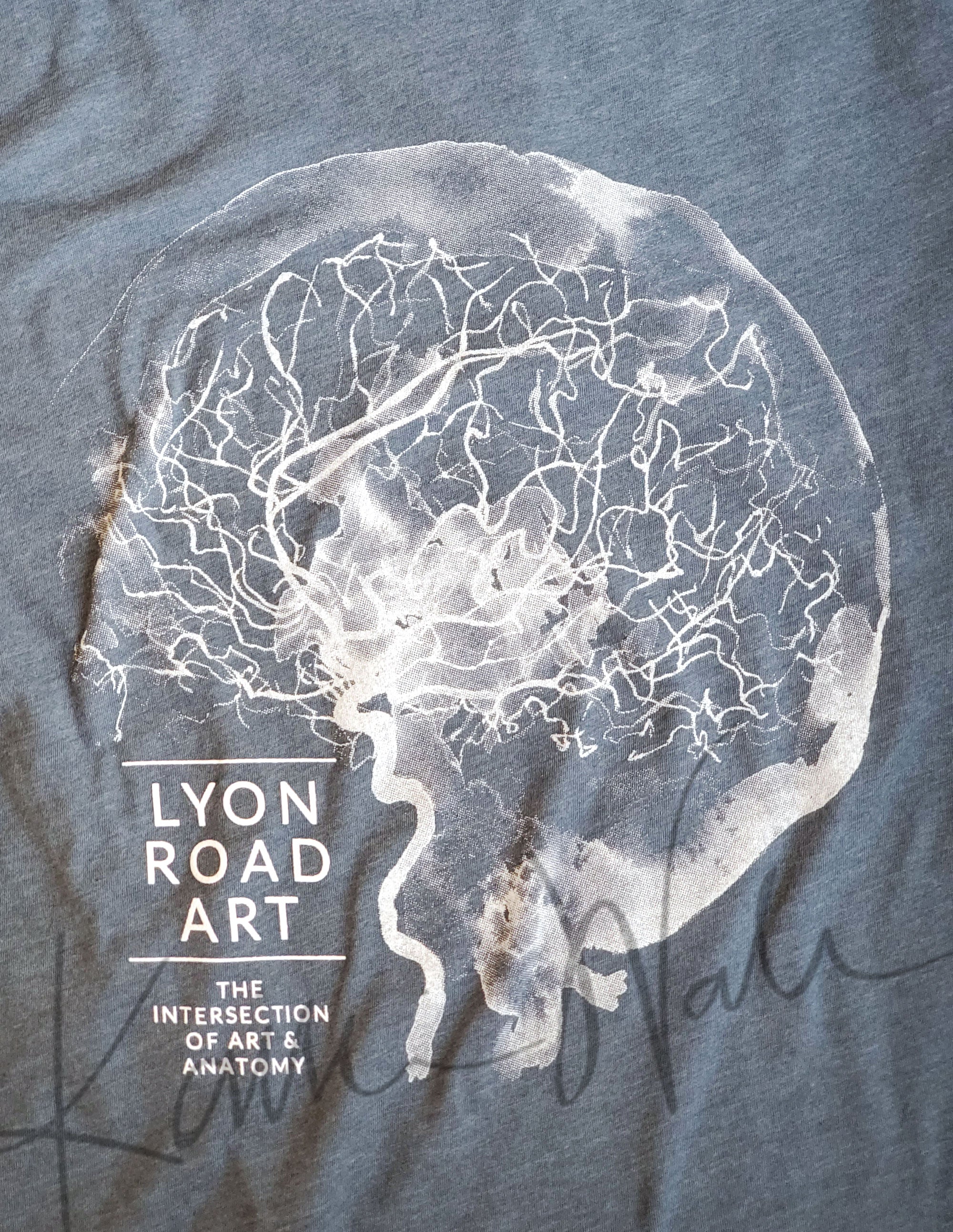 Blue Cerebral Angiography Watercolor T-Shirt