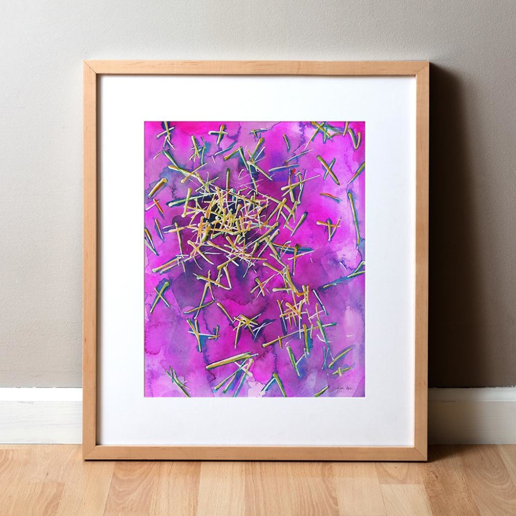 Uric Acid Crystals Watercolor Print